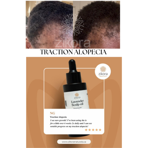 Lavender and Rosemary Hair Oil (Revitalizing Oil)